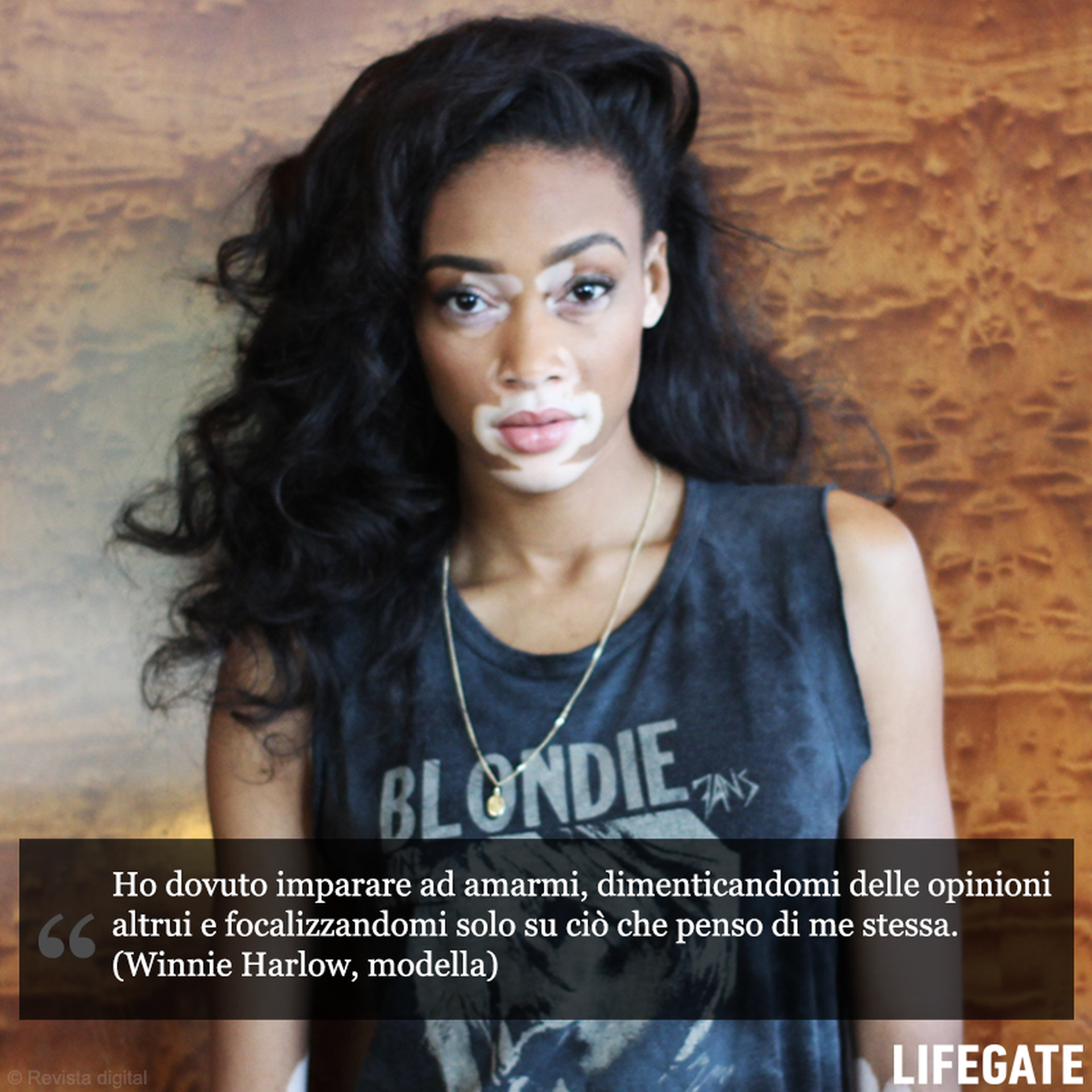 Winnie Harlow