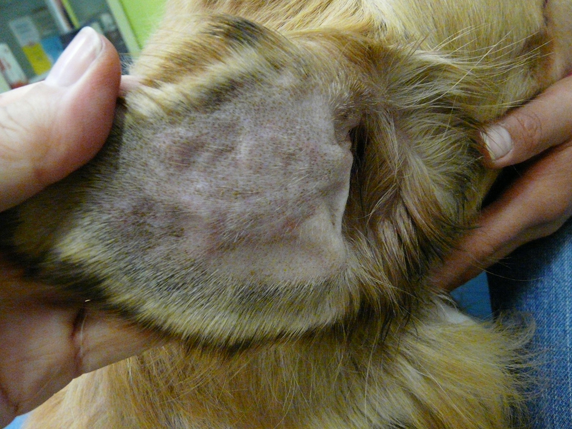 Otoematoma, l'intervento