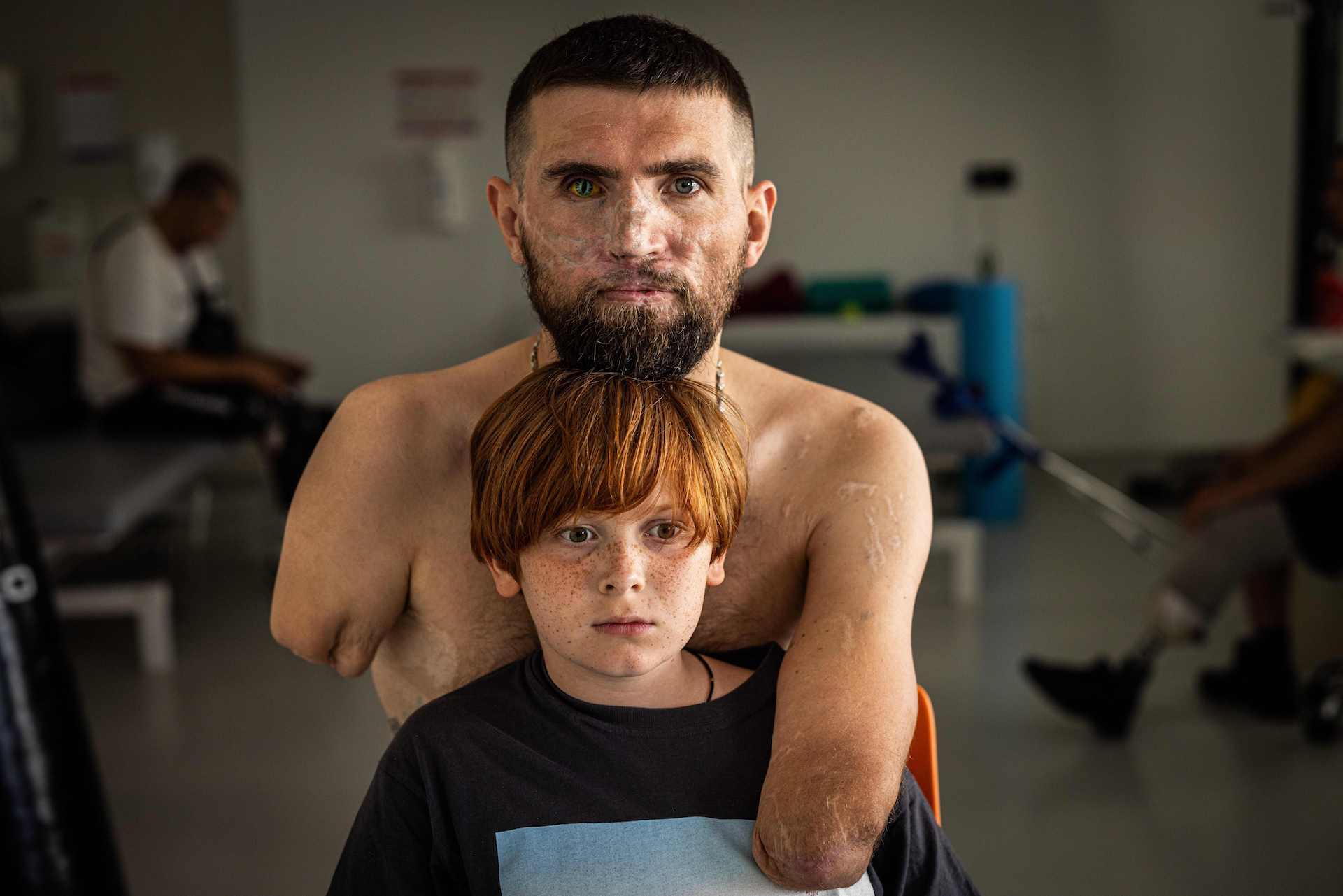 Festival fotografia etica ©Afshin Ismaeli - The Price of War