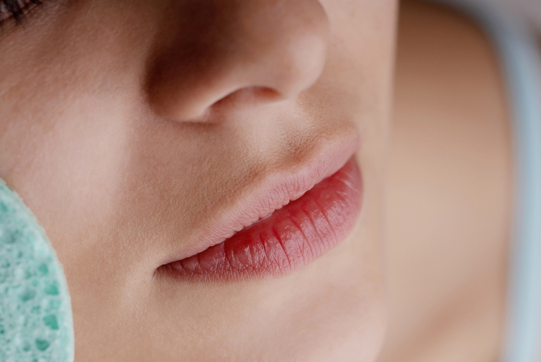 L'herpes simplex colpisce frequentemente le labbra © ingimage