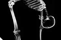 Salute della colonna vertebrale
