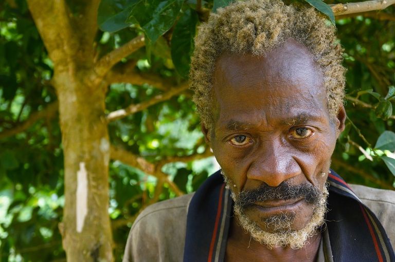 Uomo della tribù Baka vittima di violenze