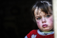 20 November is Universal Children’s Day, to celebrate their rights
