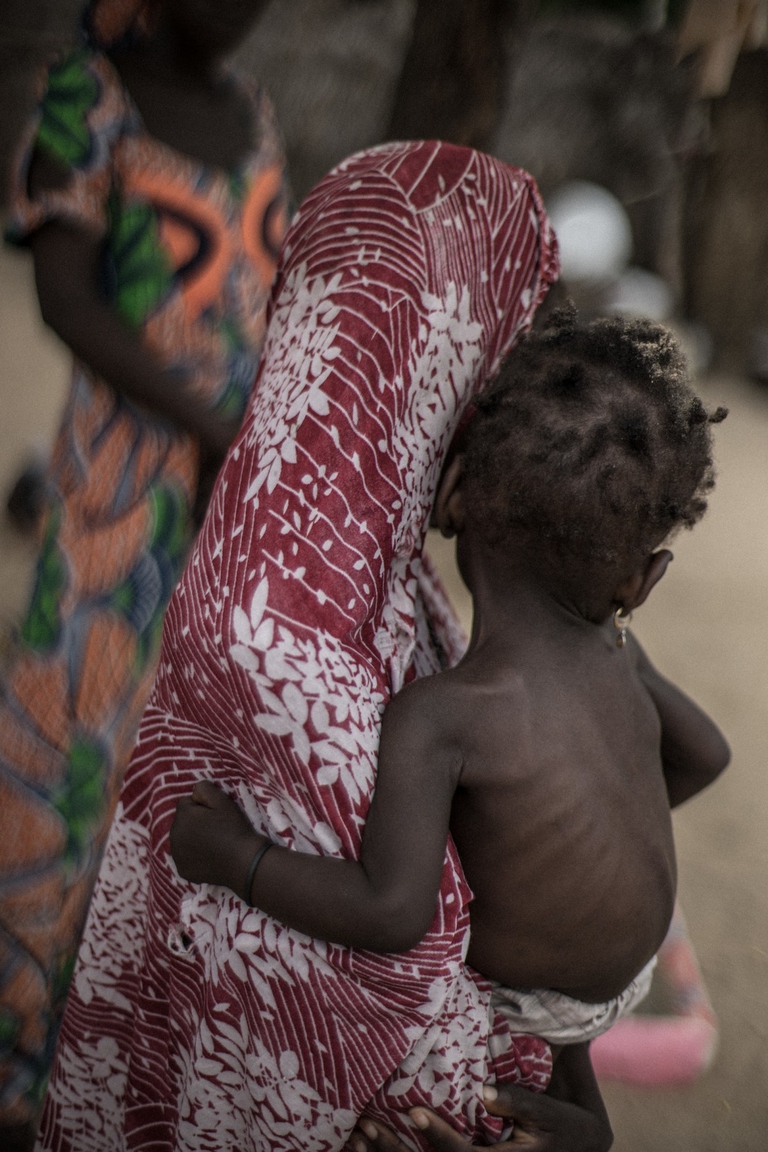 Azione contro la fame