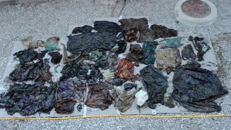 Contenuto plastica stomaco capodoglio