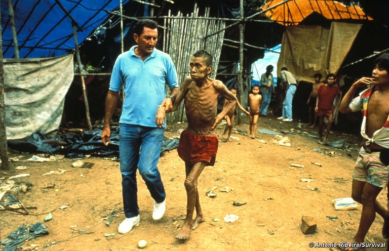 Anziano Yanomami malato che riceve assistenza medica