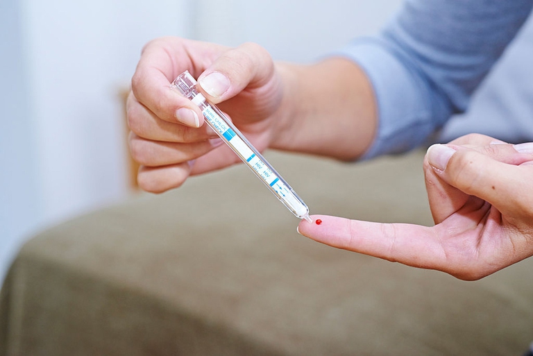test HIV