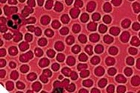 Nel futuro, prelievi di sangue senza aghi