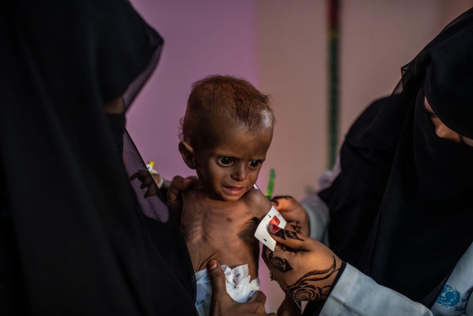 Il costo della guerra nello Yemen