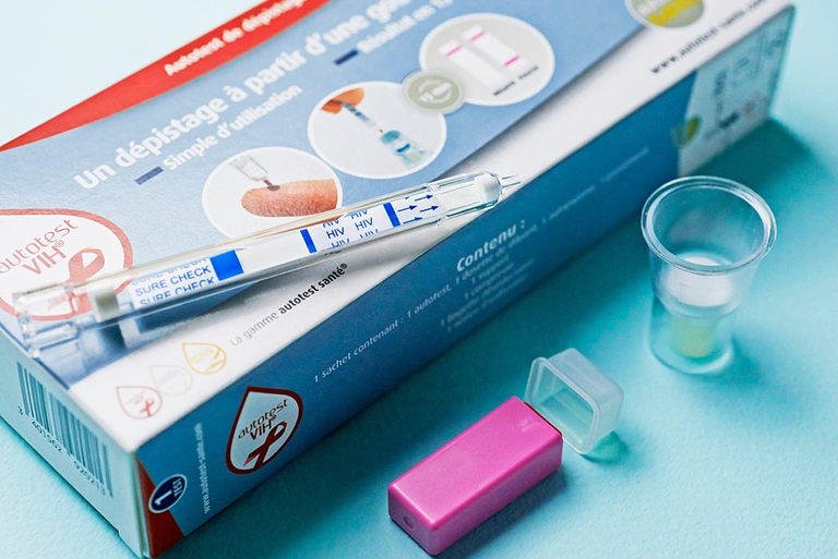 test HIV