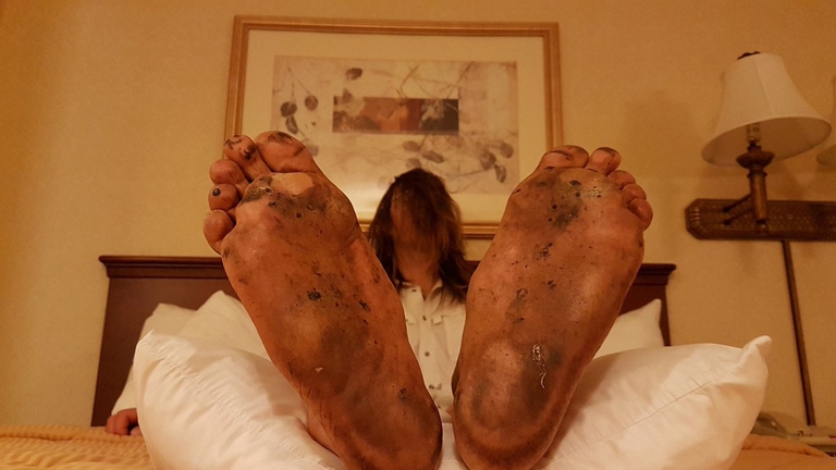 I piedi martoriati di Mark Baumer