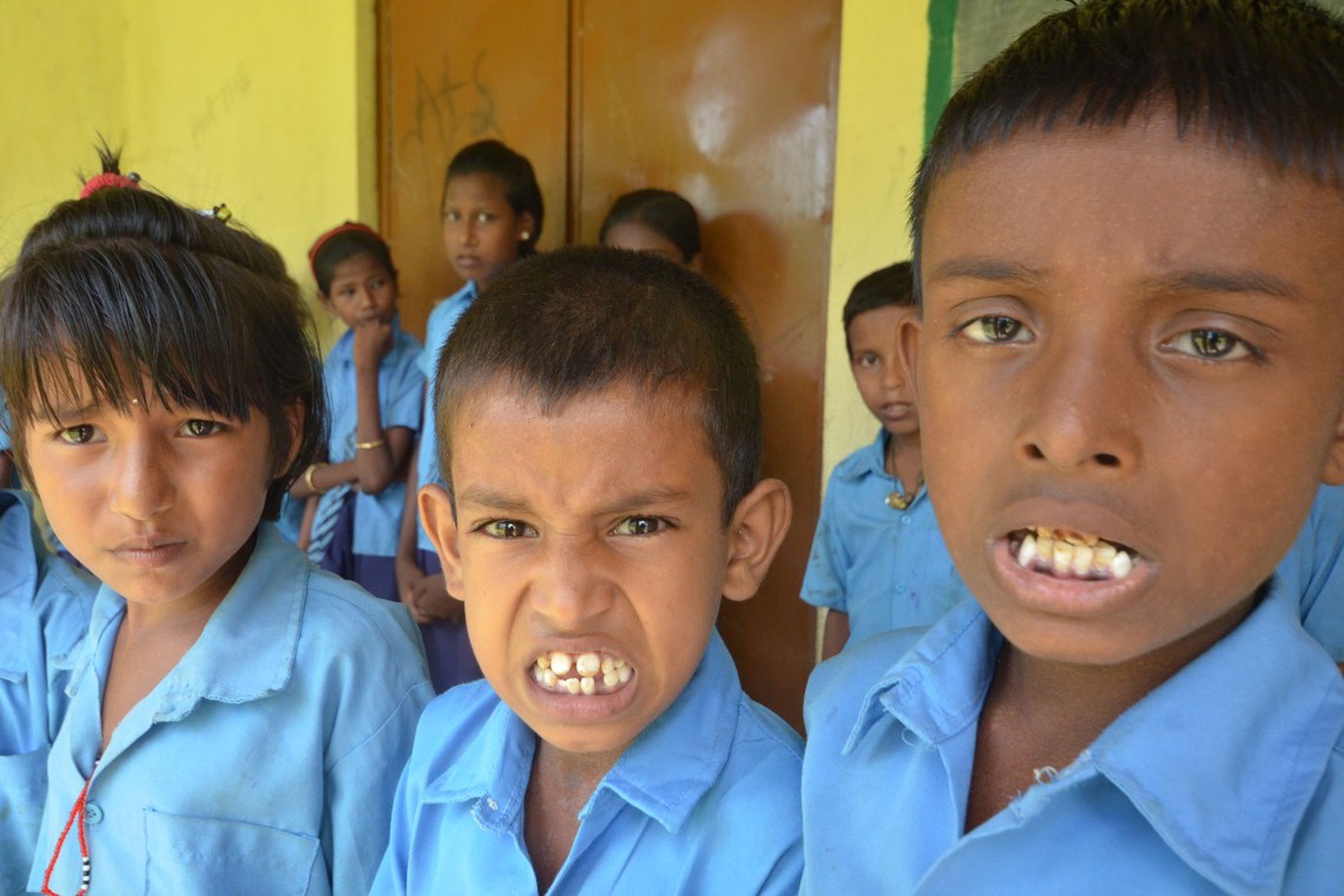 Fluoro nell'acqua. Da medicinale a sostanza tossica