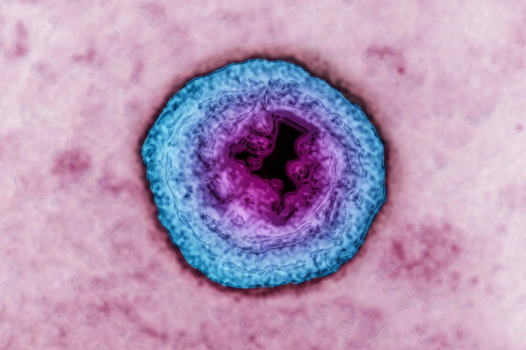 herpes virus simplex