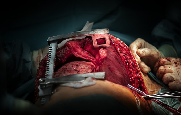 Betty Colombo, La riparazione