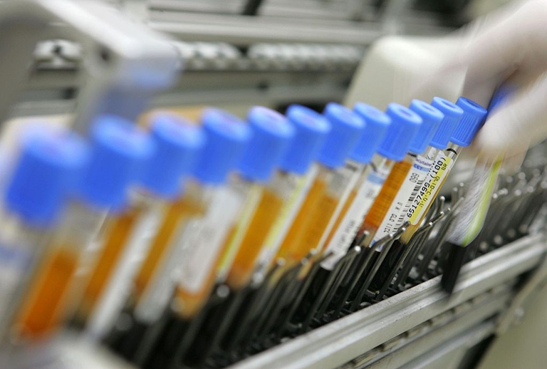 Pfas, analisi del sangue