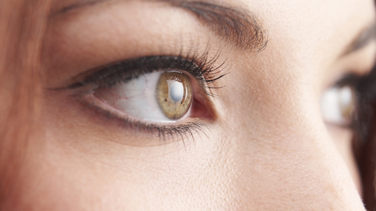 occhi arrossati omeopatia