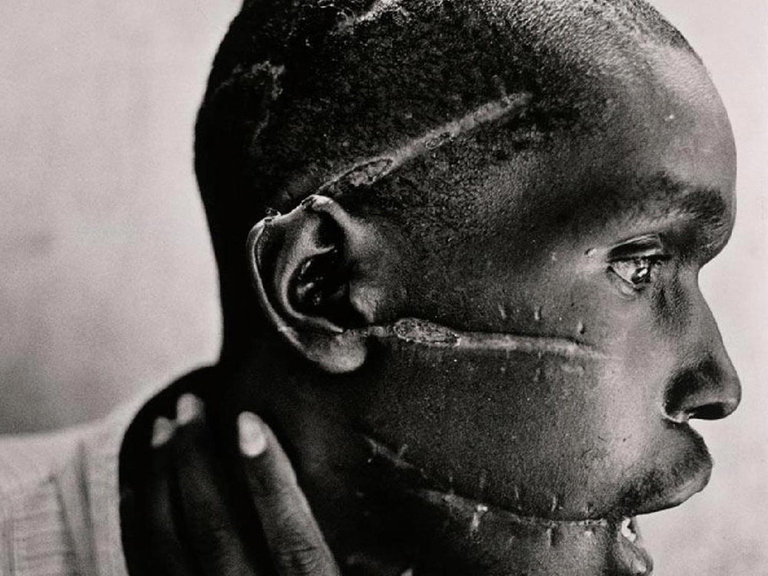 1994, James Nachtwey. Genocidio in Ruanda