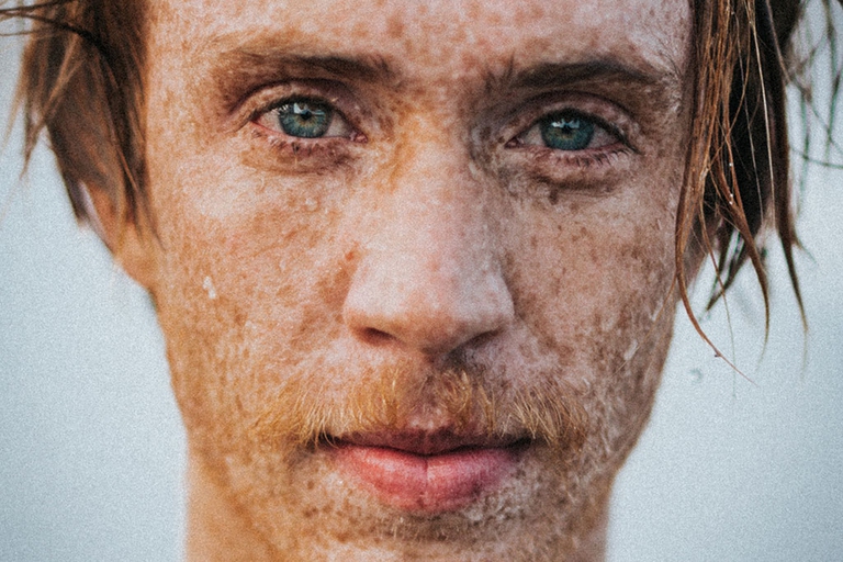 lentiggini-pelle-viso