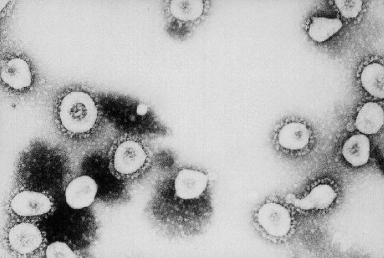 Il coronavirus visto attraverso un microscopio