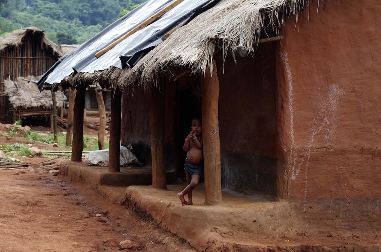 malnutrition in india