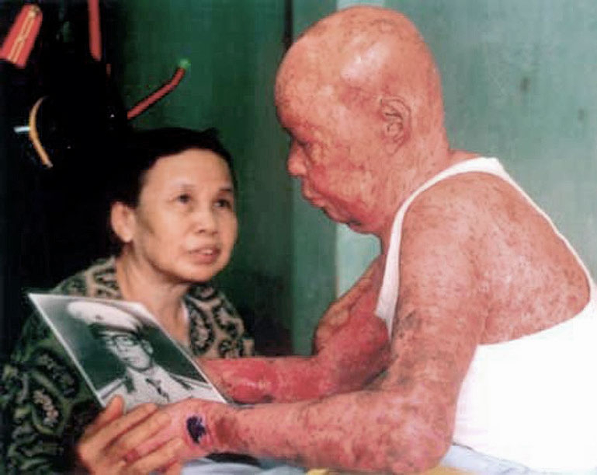 effetti-salute-agente-orange