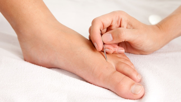 digitopressione_terapia_3